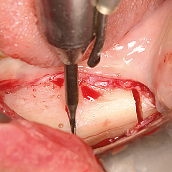 [Translate to Deutsch (Schweiz):] 