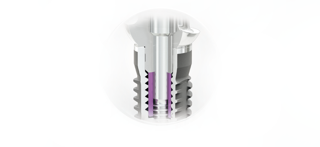 CAMLOG Tube-in-Tube Implantat-Abutment-Verbindung