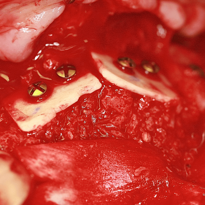 [Translate to Deutsch (Schweiz):] 