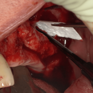 [Translate to Deutsch (Schweiz):] 