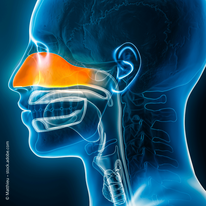 [Translate to Deutsch (Schweiz):] 