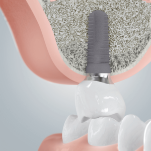 [Translate to Deutsch (Schweiz):] 