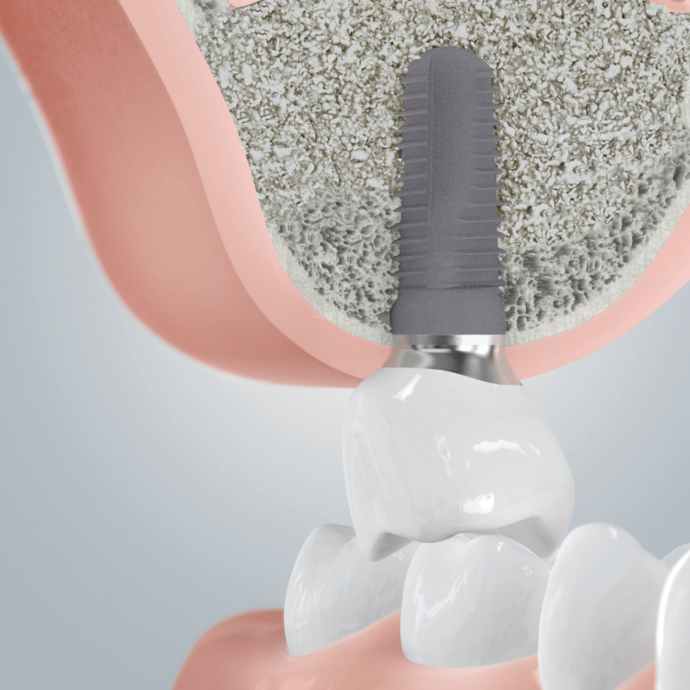 [Translate to Deutsch (Schweiz):] 