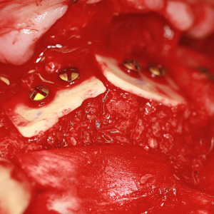 [Translate to Deutsch (Schweiz):] 