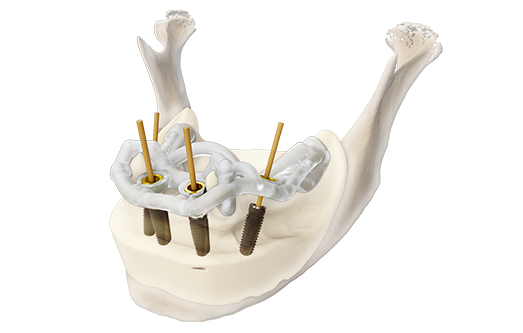 Camlog History 2018 DEDICAM Implant Planning Service