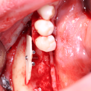 [Translate to Deutsch (Schweiz):] 